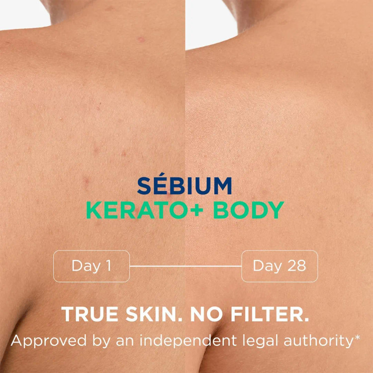 اسپری بدن ضد لک بایودرما SEBIUM KERATO+ BODY حجم ۱۵۰ میلی لیتری